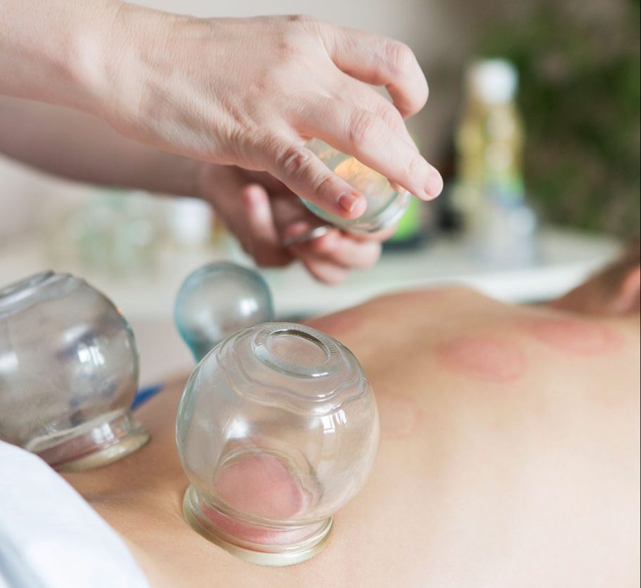 Rejuvenate Your Health with Dry Cupping